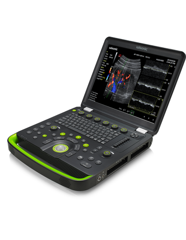 EQUIPAMENTO DE ULTRASSOM DIGITAL PORTÁTIL CLOVER 60 COLOR