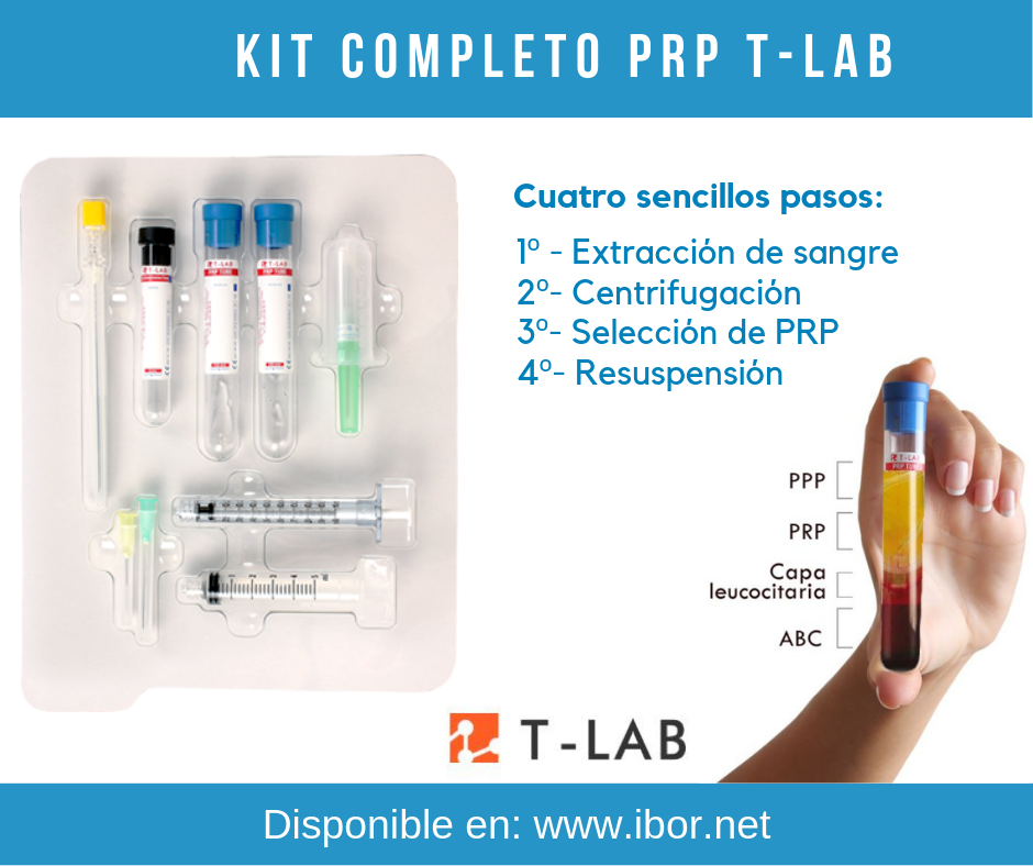 AQUISIÇÃO DE PRP: TÉCNICA FECHADA VS. TÉCNICA ABERTA TÉCNICA ABERTA